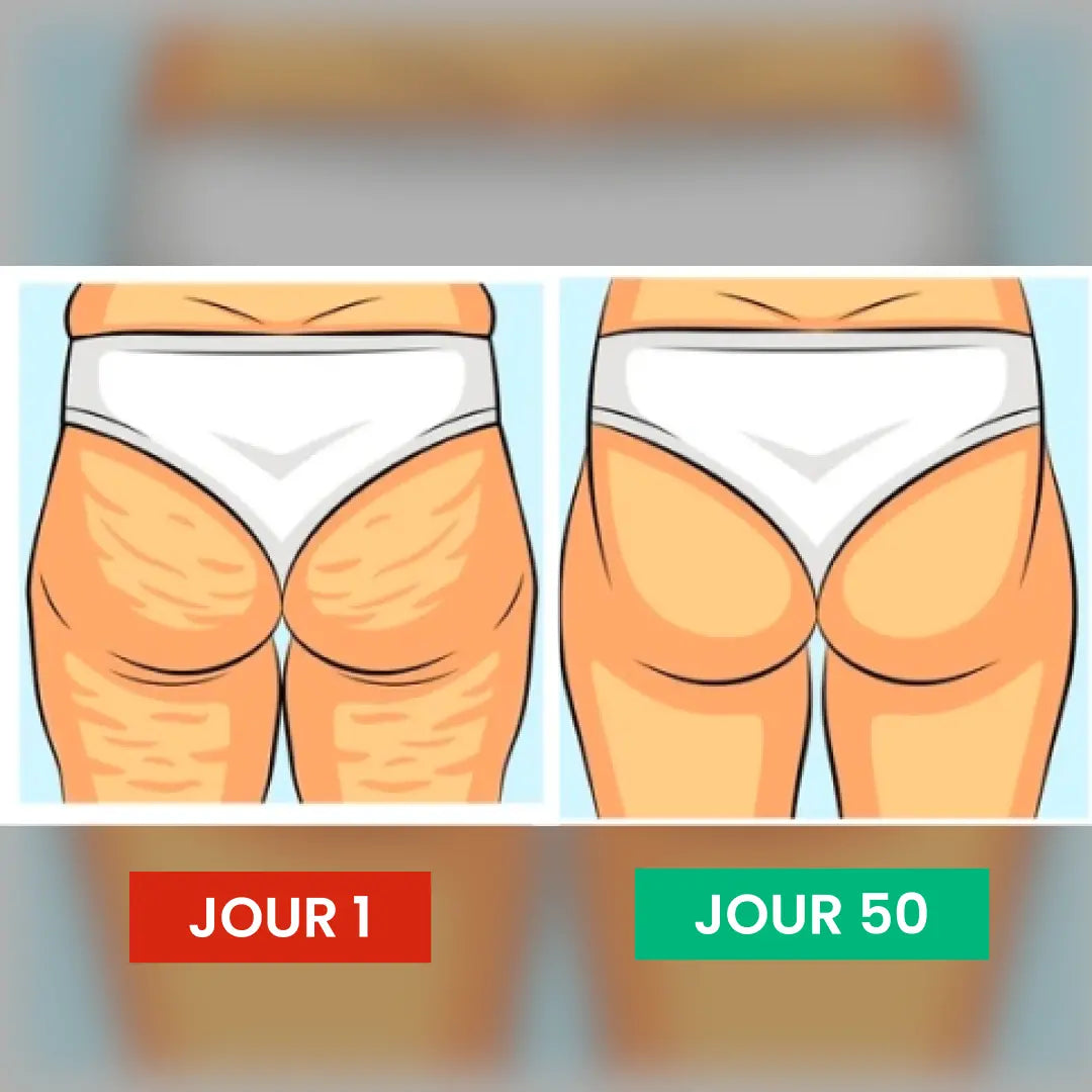 Gaine Minceur Réductrice